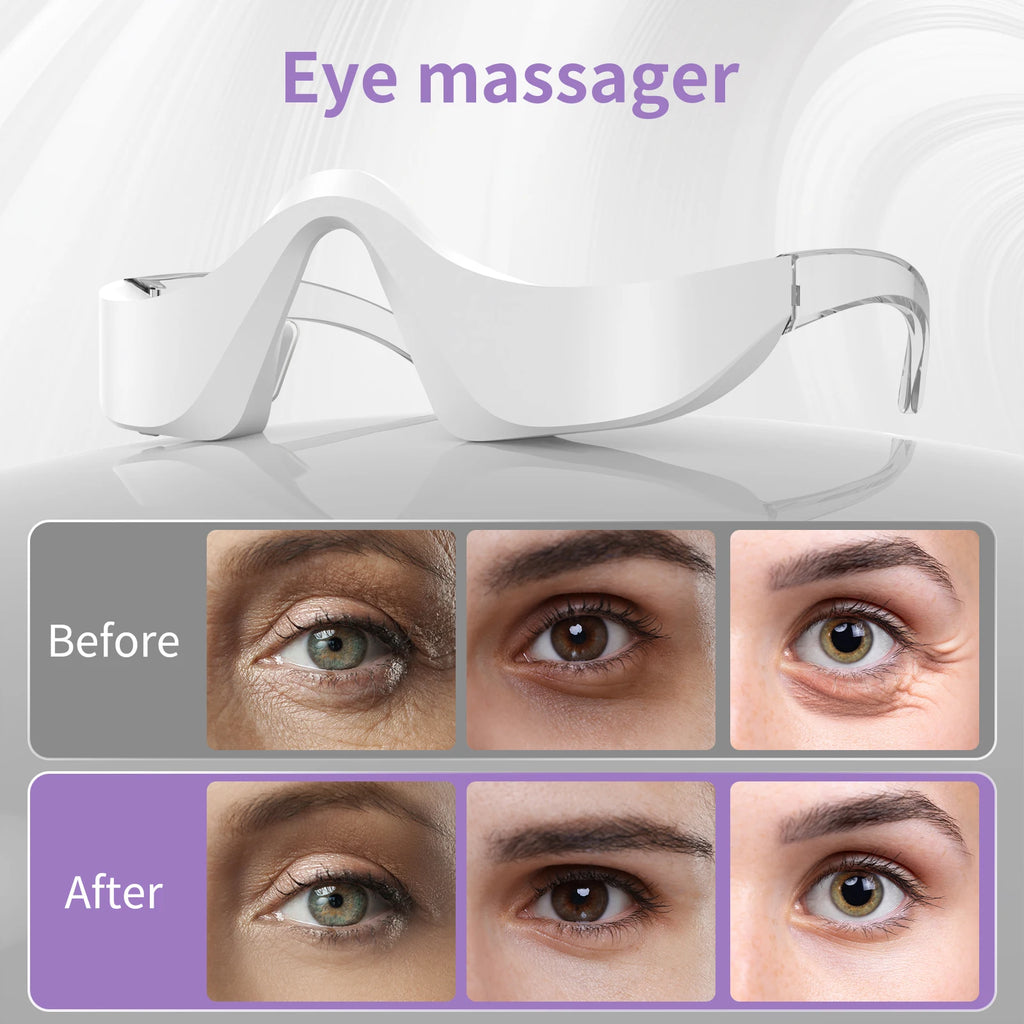 Ogossy - Eye Therapy Massager